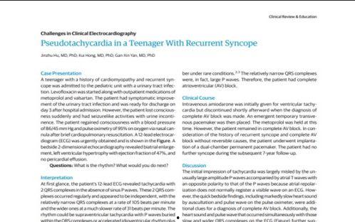 intern在线观看,跟随Intern在线观看，探索职场成长之旅